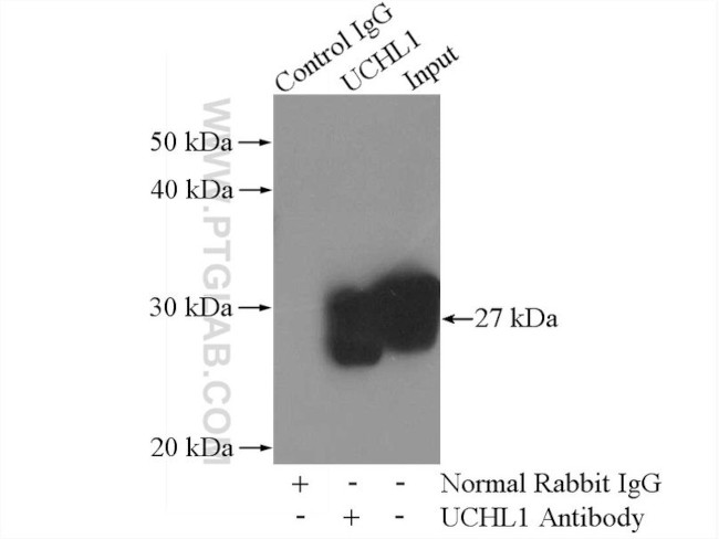 UCHL1/PGP9.5 Antibody in Immunoprecipitation (IP)