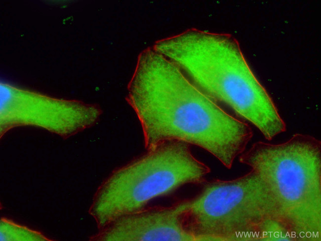 UCHL1/PGP9.5 Antibody in Immunocytochemistry (ICC/IF)