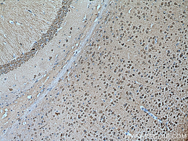 UCHL1/PGP9.5 Antibody in Immunohistochemistry (Paraffin) (IHC (P))