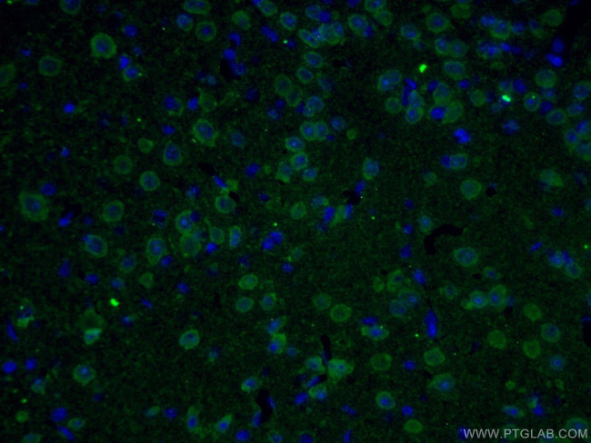 UCHL1/PGP9.5 Antibody in Immunohistochemistry (PFA fixed) (IHC (PFA))