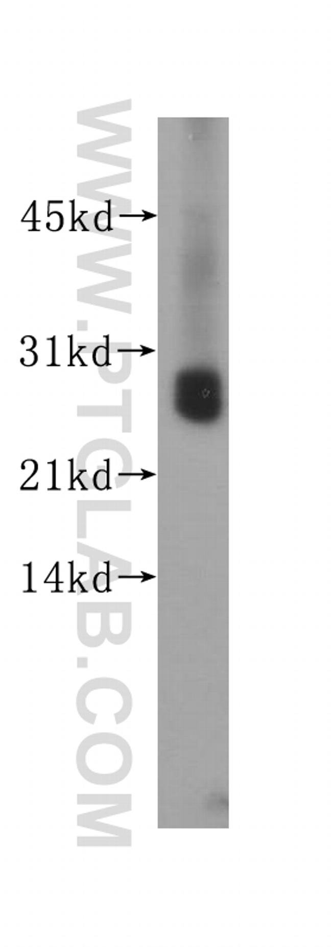 UCHL1/PGP9.5 Antibody in Western Blot (WB)