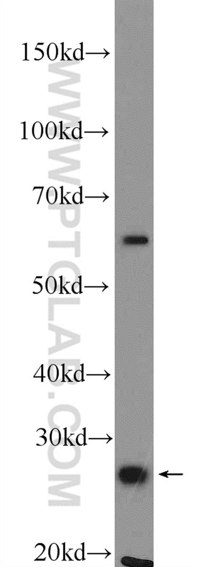 UCHL1/PGP9.5 Antibody in Western Blot (WB)