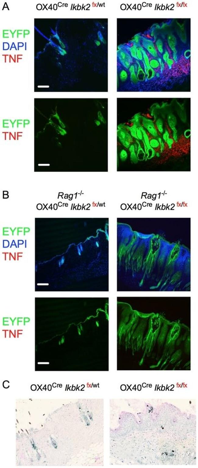 TNF alpha Antibody in Immunohistochemistry (IHC)