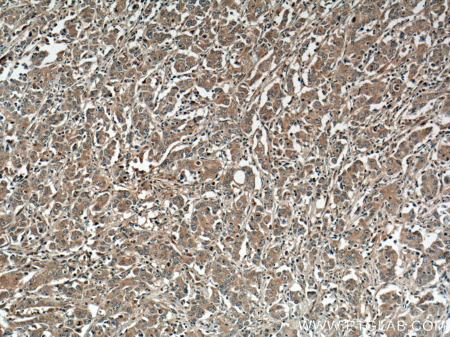 DNM3 Antibody in Immunohistochemistry (Paraffin) (IHC (P))