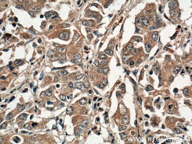 DNM3 Antibody in Immunohistochemistry (Paraffin) (IHC (P))