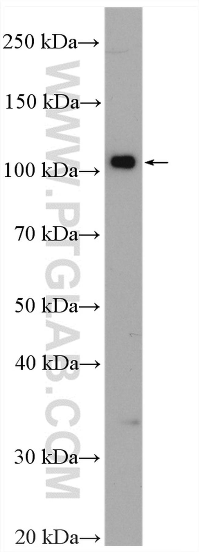 DNM3 Antibody in Western Blot (WB)