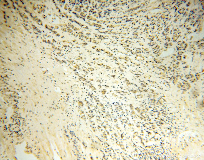 DNM3 Antibody in Immunohistochemistry (Paraffin) (IHC (P))