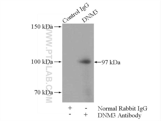 DNM3 Antibody in Immunoprecipitation (IP)