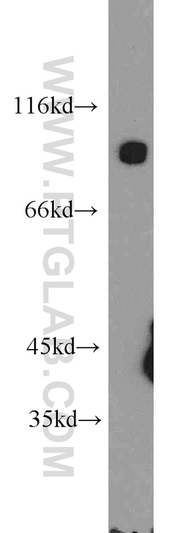 DNM3 Antibody in Western Blot (WB)