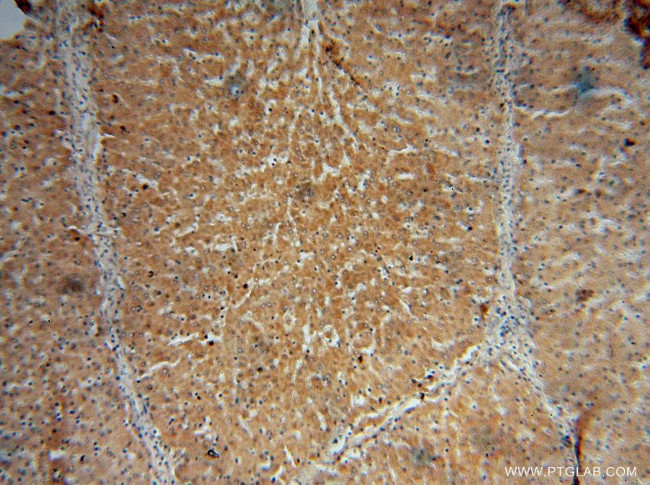 CYP27A1 Antibody in Immunohistochemistry (Paraffin) (IHC (P))