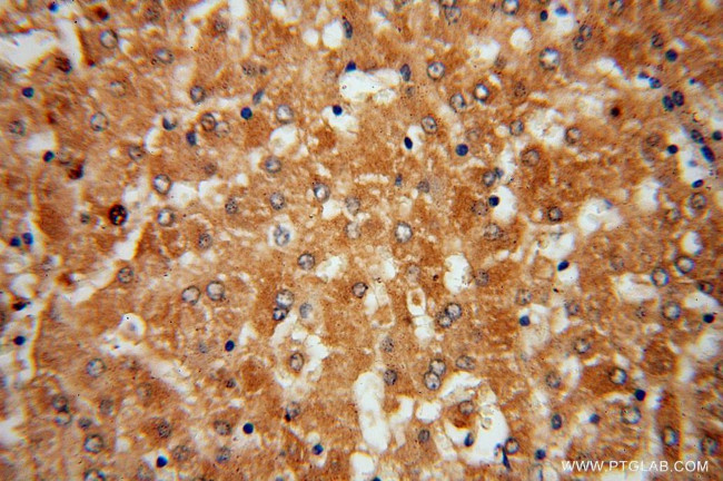 CYP27A1 Antibody in Immunohistochemistry (Paraffin) (IHC (P))