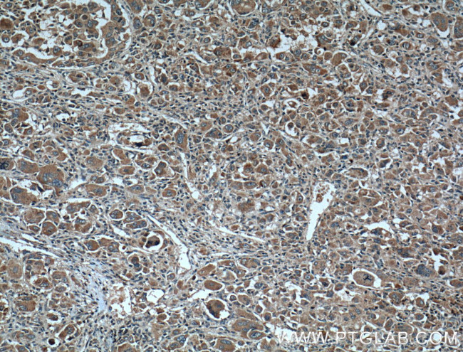 CYP27A1 Antibody in Immunohistochemistry (Paraffin) (IHC (P))