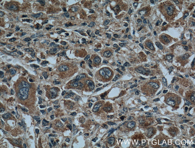 CYP27A1 Antibody in Immunohistochemistry (Paraffin) (IHC (P))