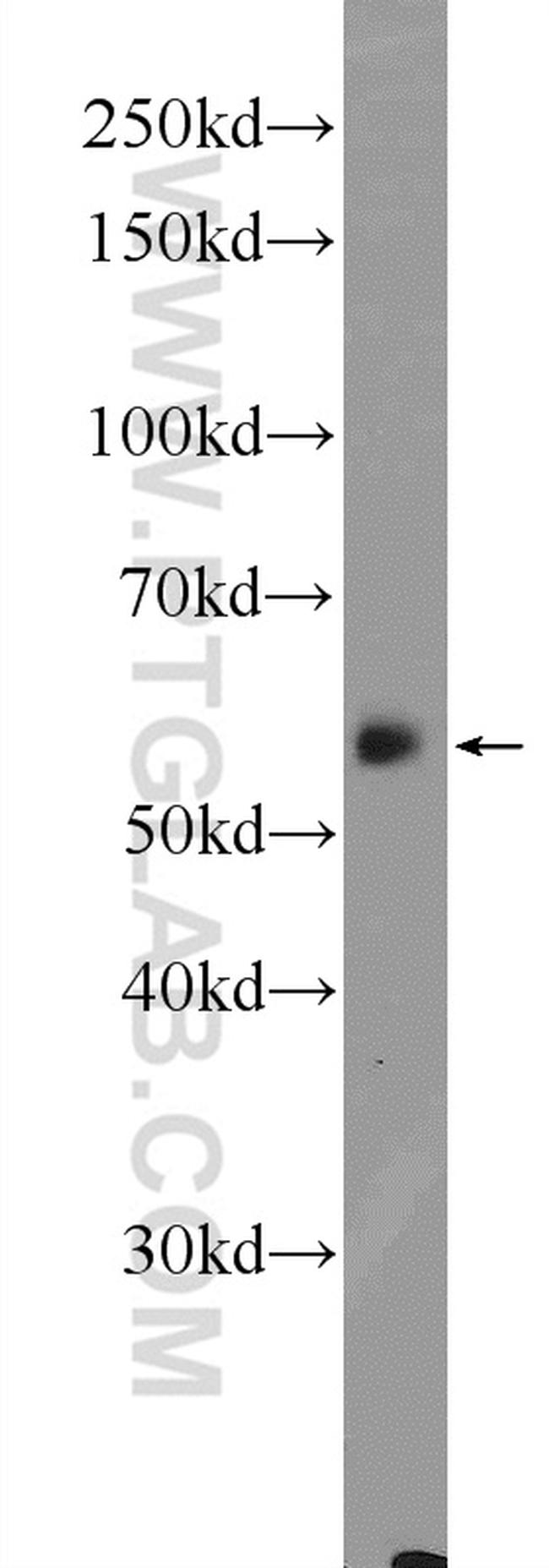 CYP27A1 Antibody in Western Blot (WB)