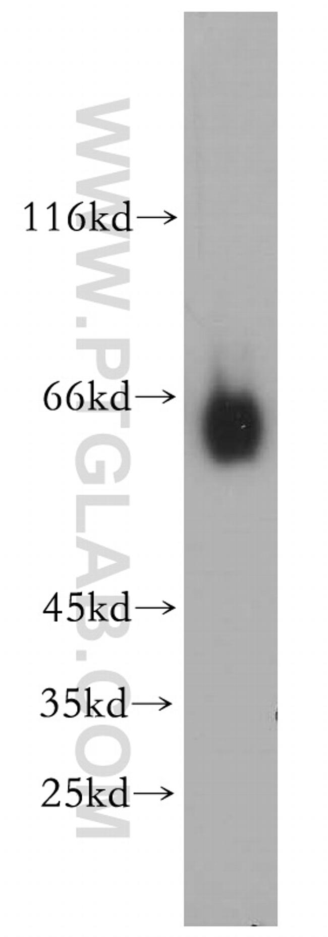 CYP27A1 Antibody in Western Blot (WB)