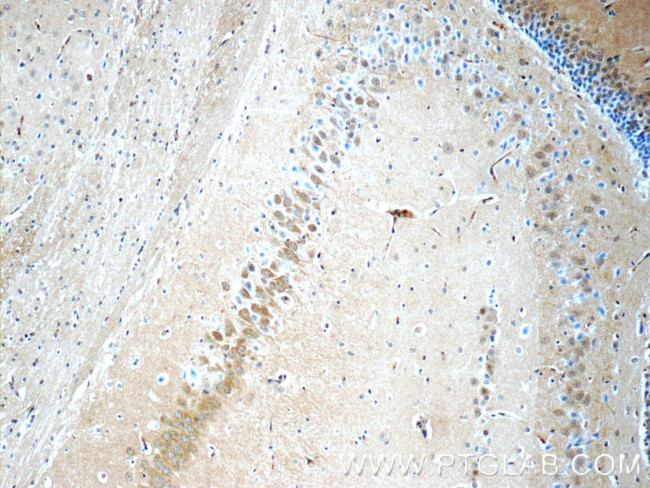 CDK5RAP1 Antibody in Immunohistochemistry (Paraffin) (IHC (P))