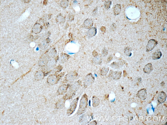 CDK5RAP1 Antibody in Immunohistochemistry (Paraffin) (IHC (P))