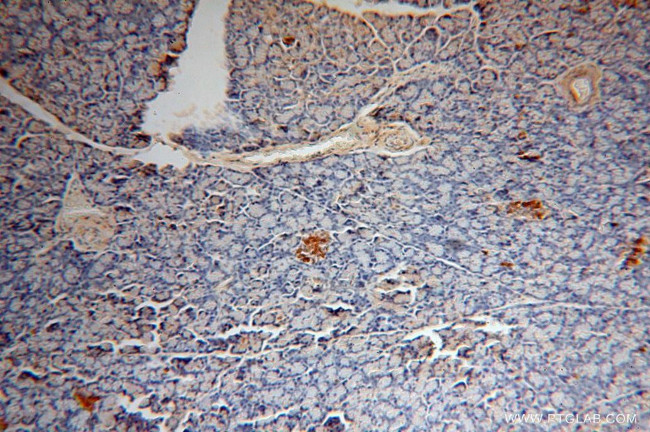 CDK5RAP1 Antibody in Immunohistochemistry (Paraffin) (IHC (P))