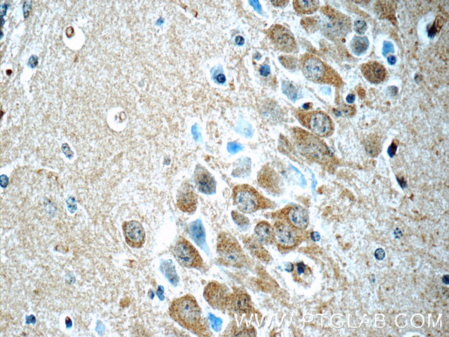 CDK5RAP1 Antibody in Immunohistochemistry (Paraffin) (IHC (P))