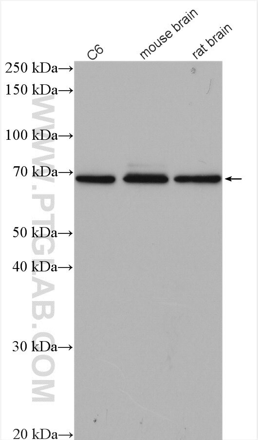 CDK5RAP1 Antibody in Western Blot (WB)