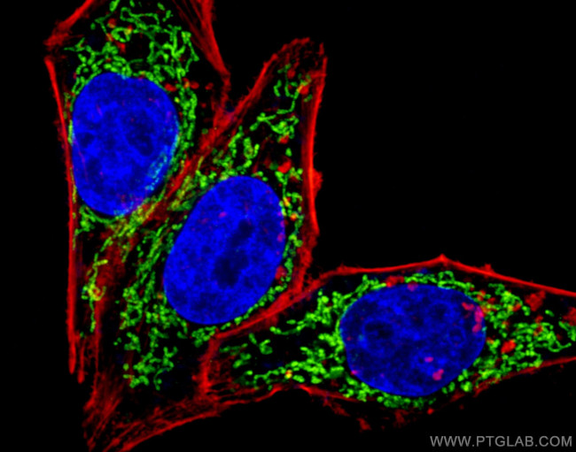 UQCRC2 Antibody in Immunocytochemistry (ICC/IF)