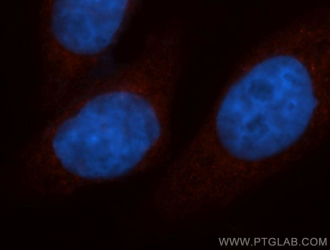 UQCRC2 Antibody in Immunocytochemistry (ICC/IF)