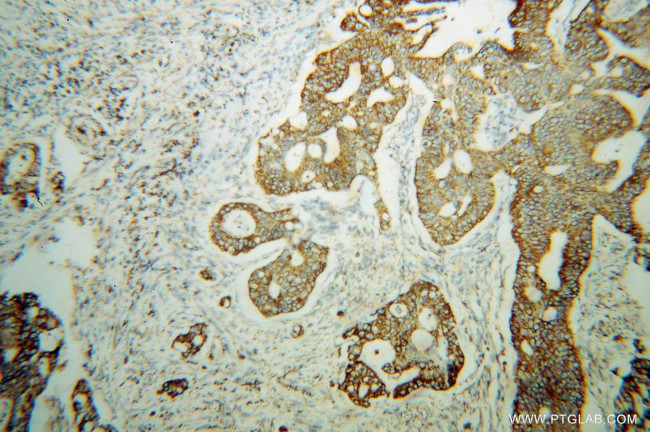 UQCRC2 Antibody in Immunohistochemistry (Paraffin) (IHC (P))