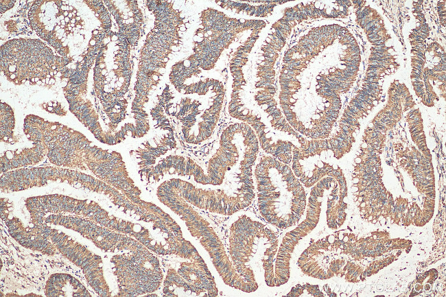 UQCRC2 Antibody in Immunohistochemistry (Paraffin) (IHC (P))