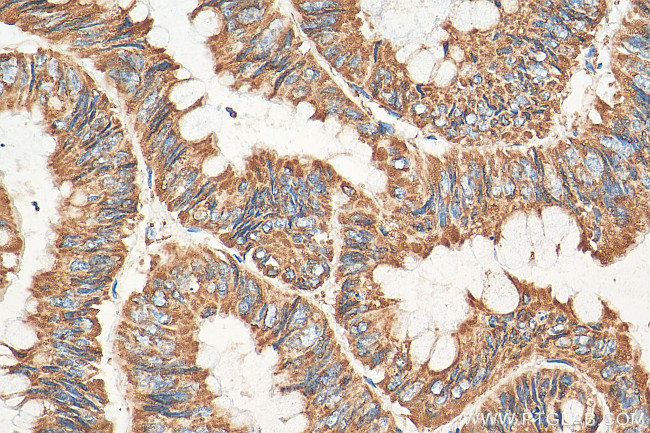 UQCRC2 Antibody in Immunohistochemistry (Paraffin) (IHC (P))