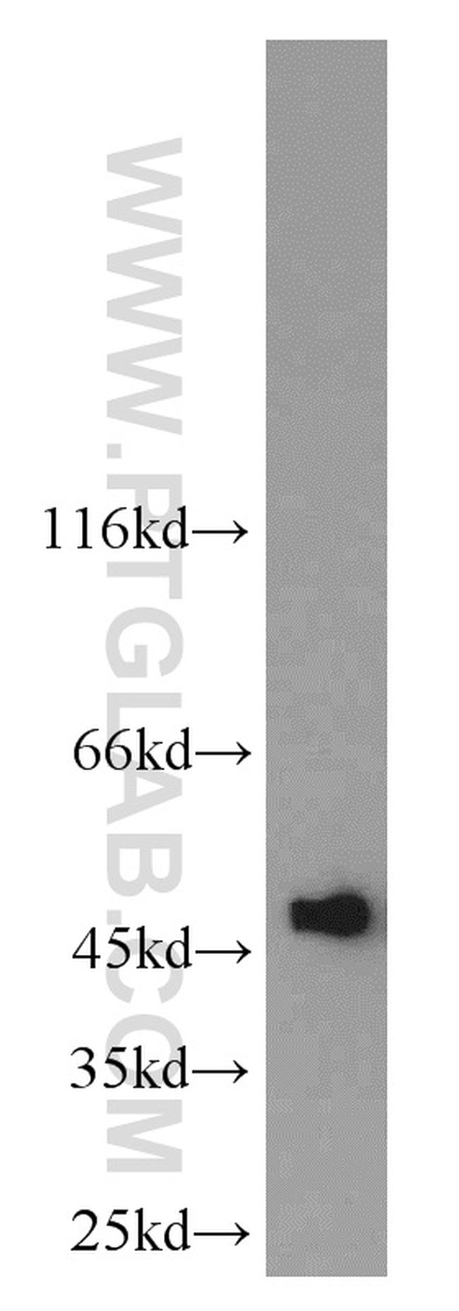 UQCRC2 Antibody in Western Blot (WB)