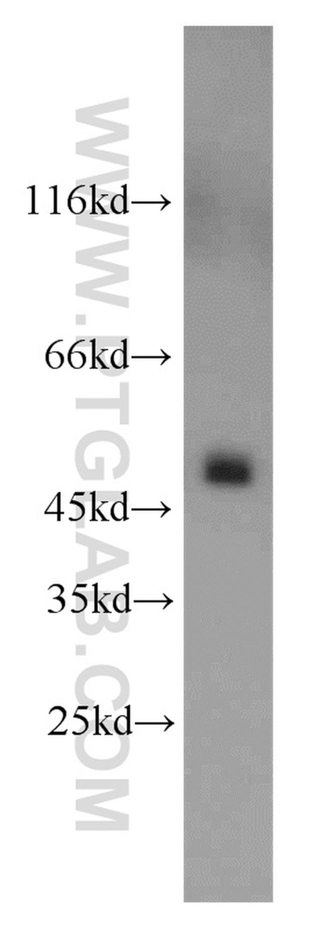 UQCRC2 Antibody in Western Blot (WB)