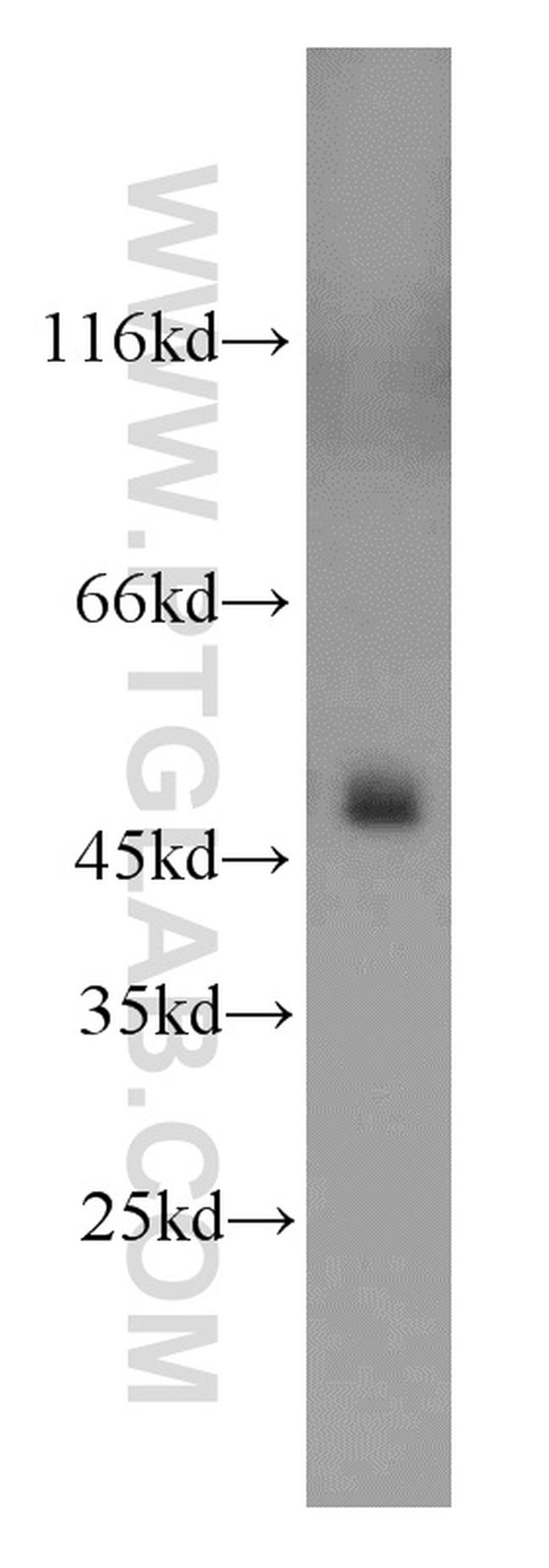 UQCRC2 Antibody in Western Blot (WB)