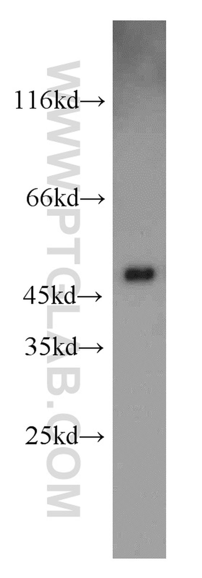 UQCRC2 Antibody in Western Blot (WB)