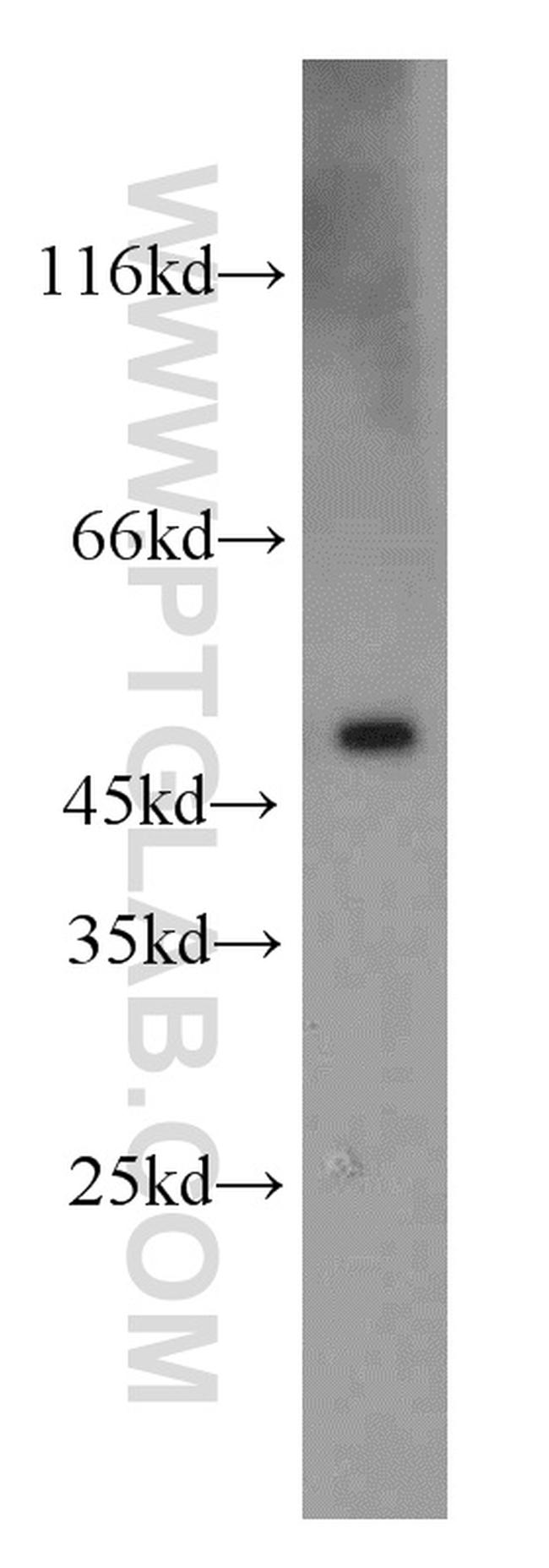 UQCRC2 Antibody in Western Blot (WB)
