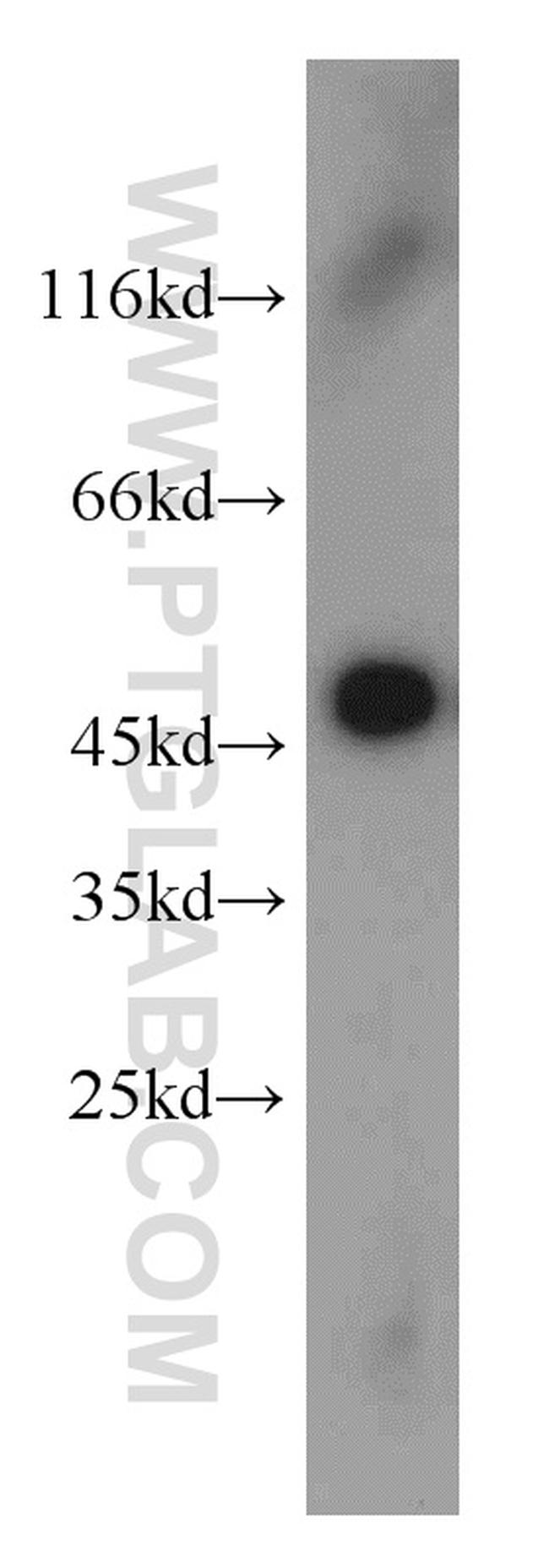 UQCRC2 Antibody in Western Blot (WB)