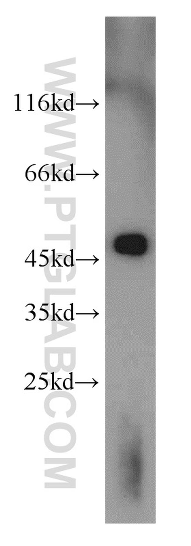 UQCRC2 Antibody in Western Blot (WB)