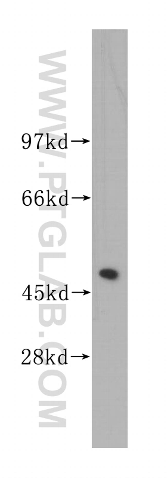 UQCRC2 Antibody in Western Blot (WB)