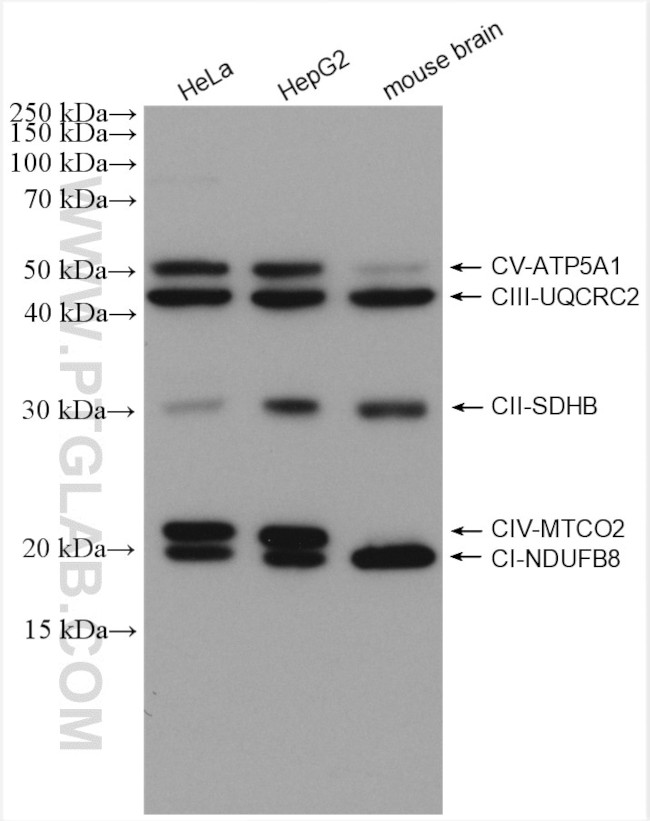 UQCRC2 Antibody in Western Blot (WB)