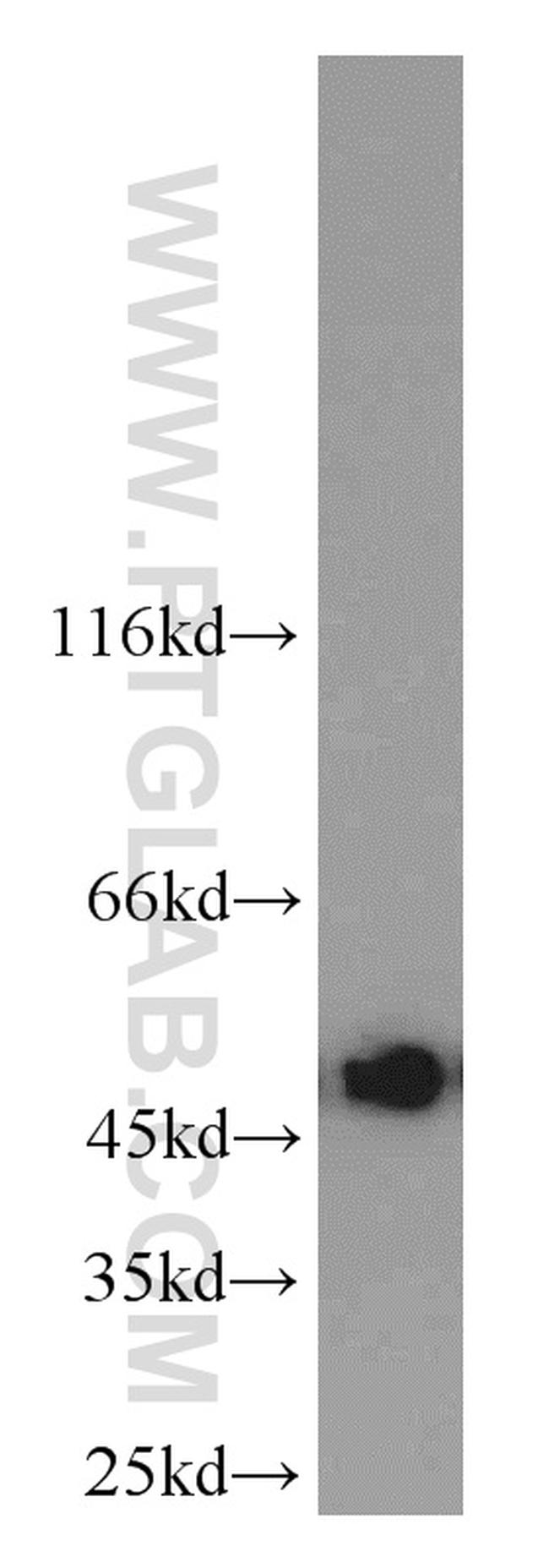 UQCRC2 Antibody in Western Blot (WB)