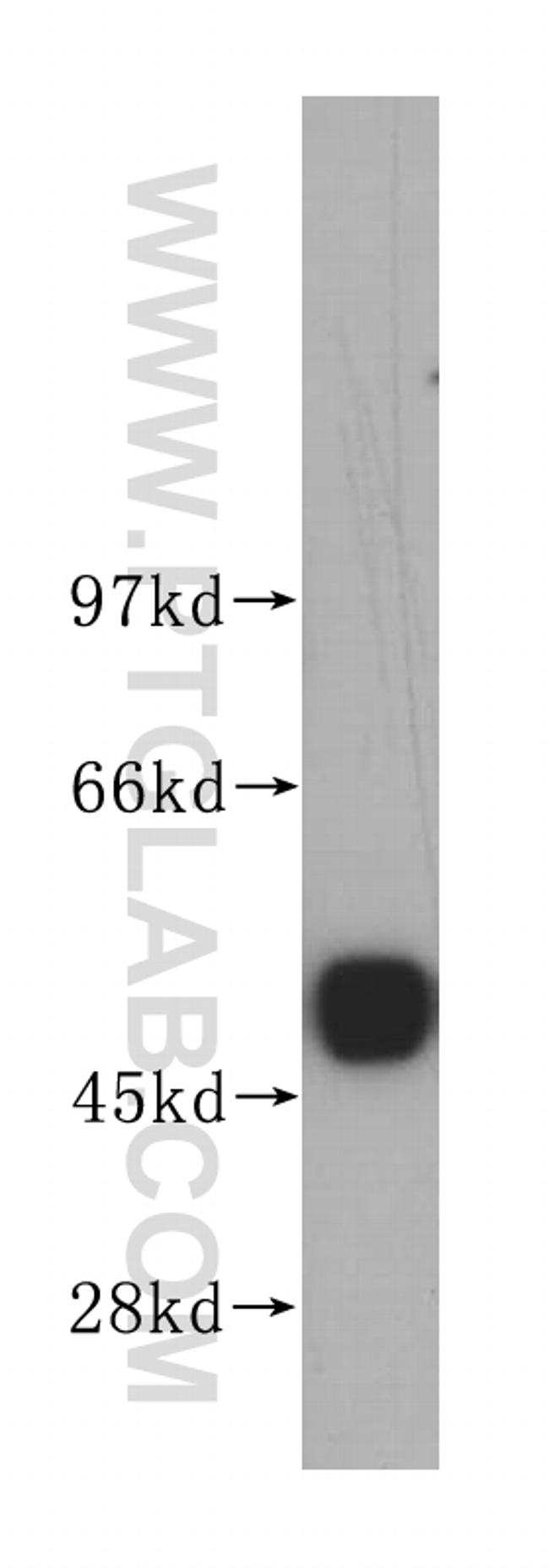 UQCRC2 Antibody in Western Blot (WB)