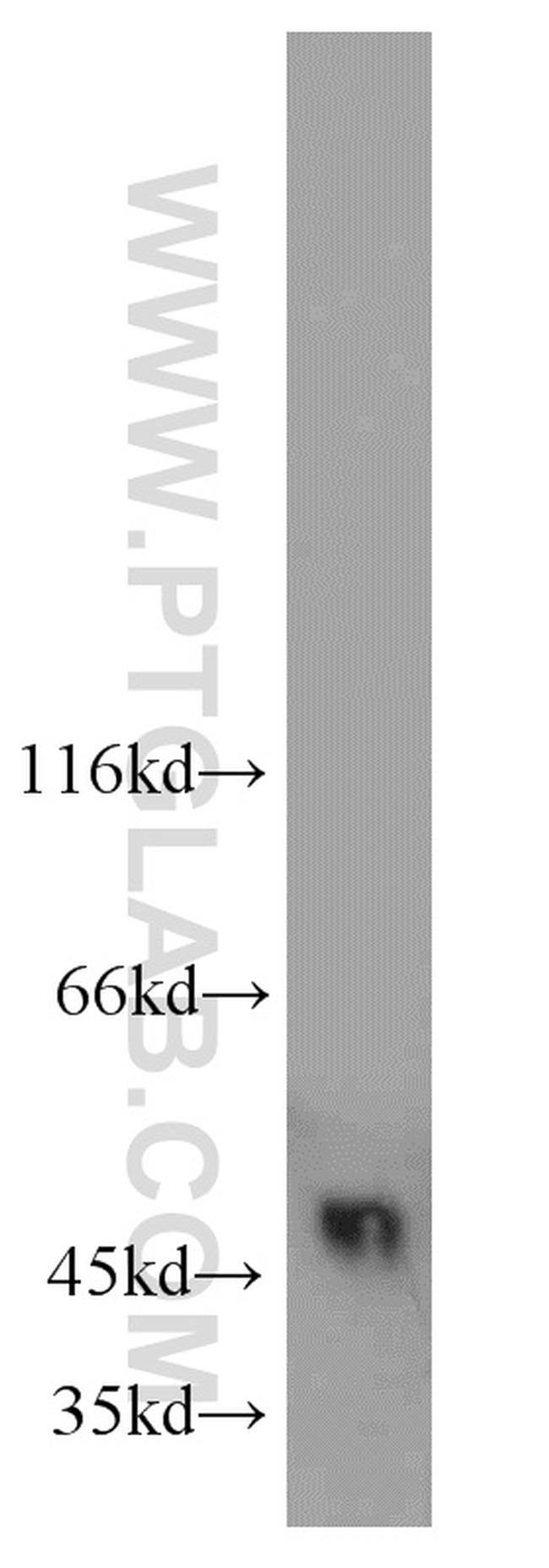 UQCRC2 Antibody in Western Blot (WB)