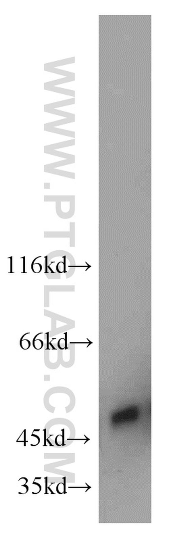 UQCRC2 Antibody in Western Blot (WB)