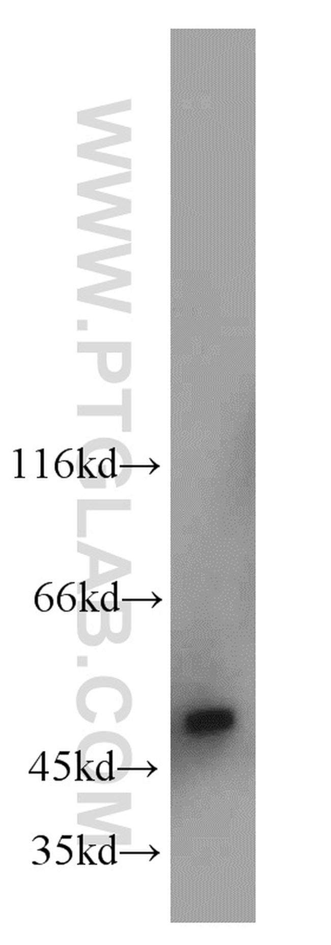 UQCRC2 Antibody in Western Blot (WB)