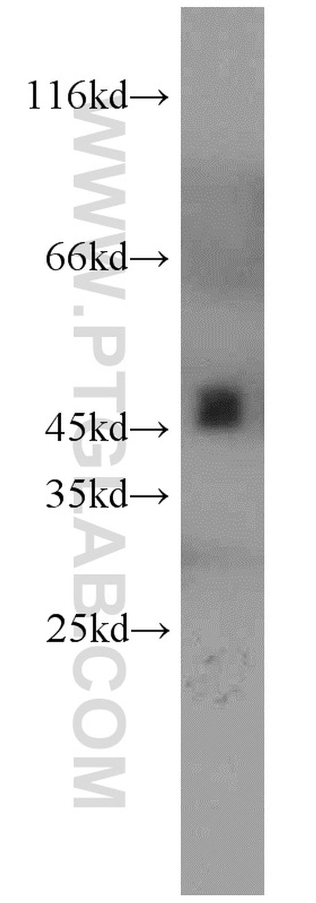 UQCRC2 Antibody in Western Blot (WB)