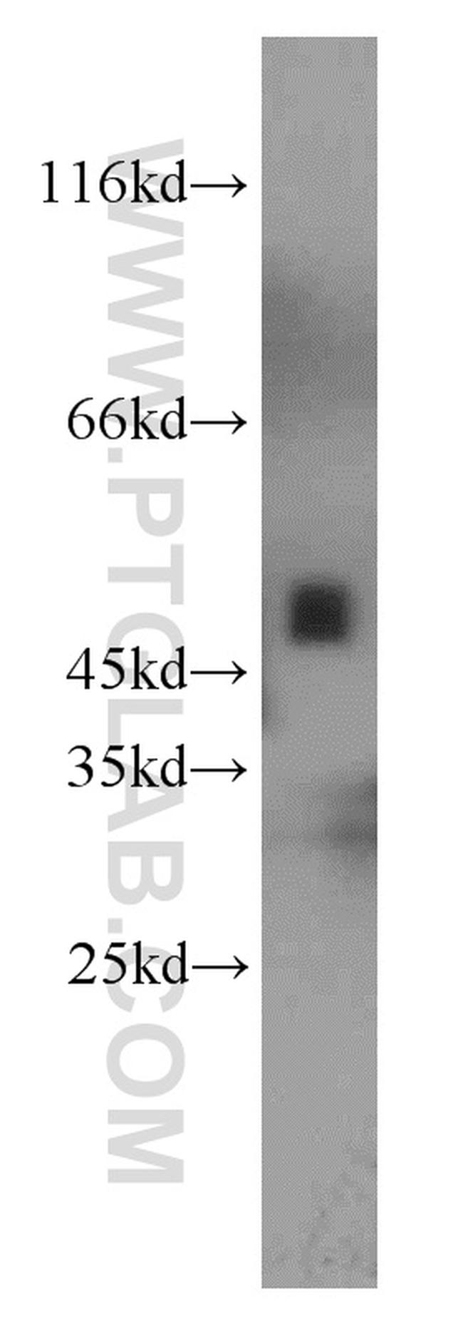 UQCRC2 Antibody in Western Blot (WB)