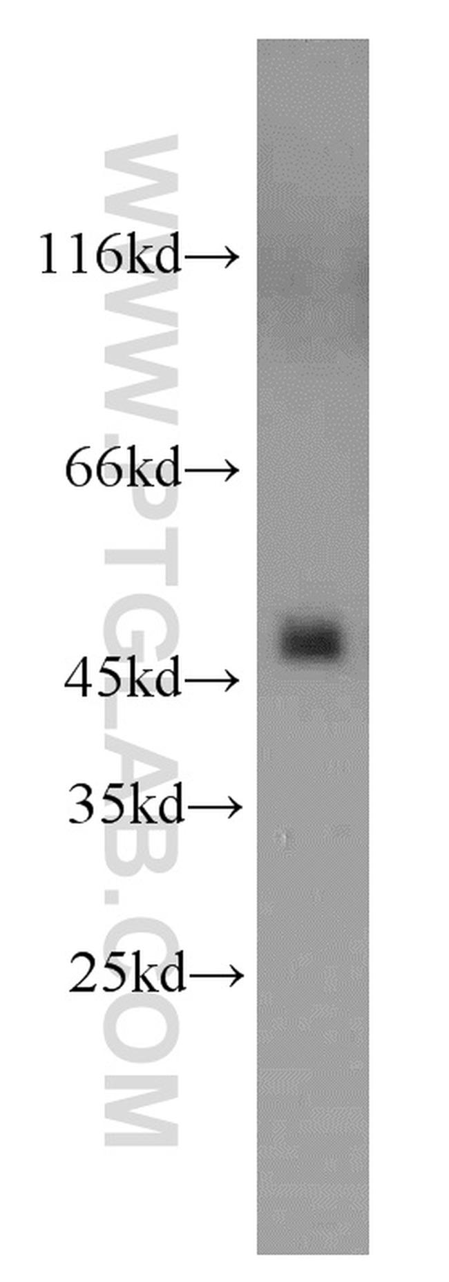 UQCRC2 Antibody in Western Blot (WB)