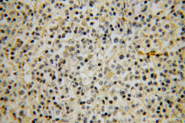 ACVRL1 Antibody in Immunohistochemistry (Paraffin) (IHC (P))