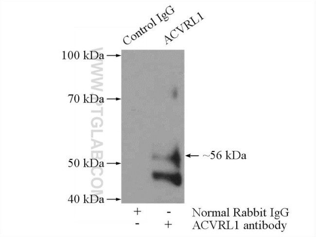 ACVRL1 Antibody in Immunoprecipitation (IP)