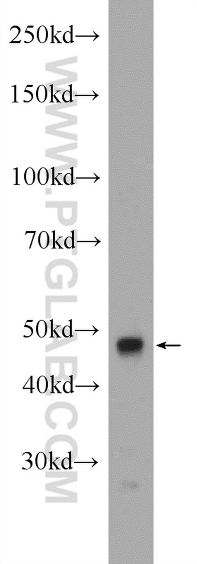 CLP1 Antibody in Western Blot (WB)