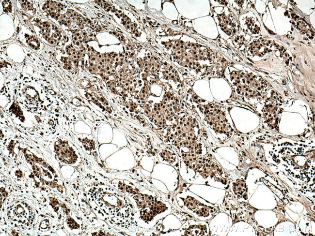 PSMD2 Antibody in Immunohistochemistry (Paraffin) (IHC (P))